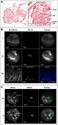 Design, fabrication, and preclinical testing of a miniaturized, multispectral, chip-on-tip, imaging probe for intraluminal fluorescence imaging of the gastrointestinal tract